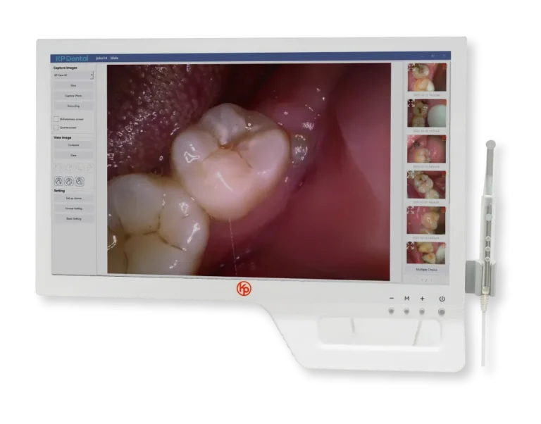 Cámara Intraoral KP-CAM PRO